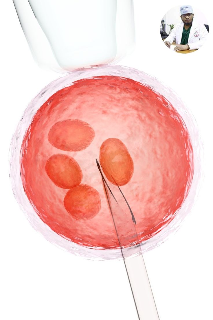 Illustration of eggs being fertilised in the laboratory