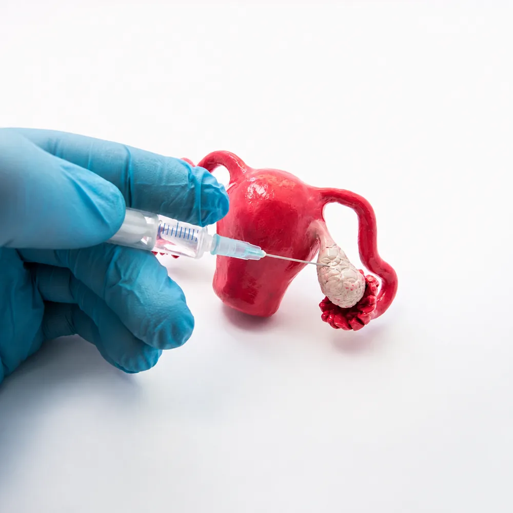 Hormonal injection being administered near an anatomical model of the ovary
