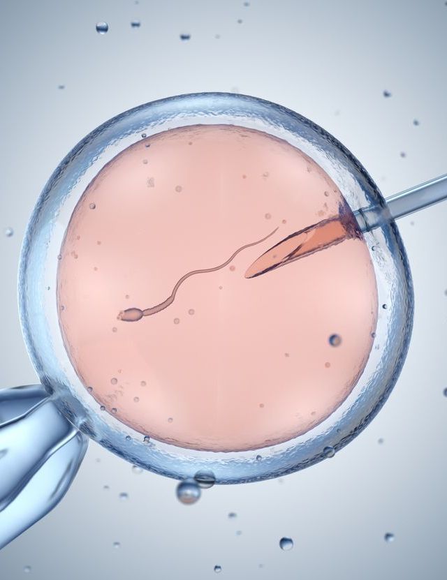 Laboratory illustration of sperm being prepared