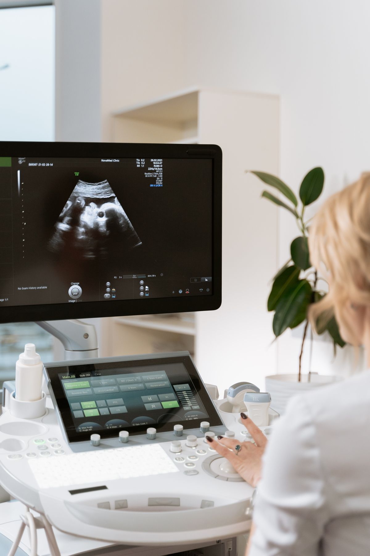 Ultrasound monitor during a follicular tracking scan