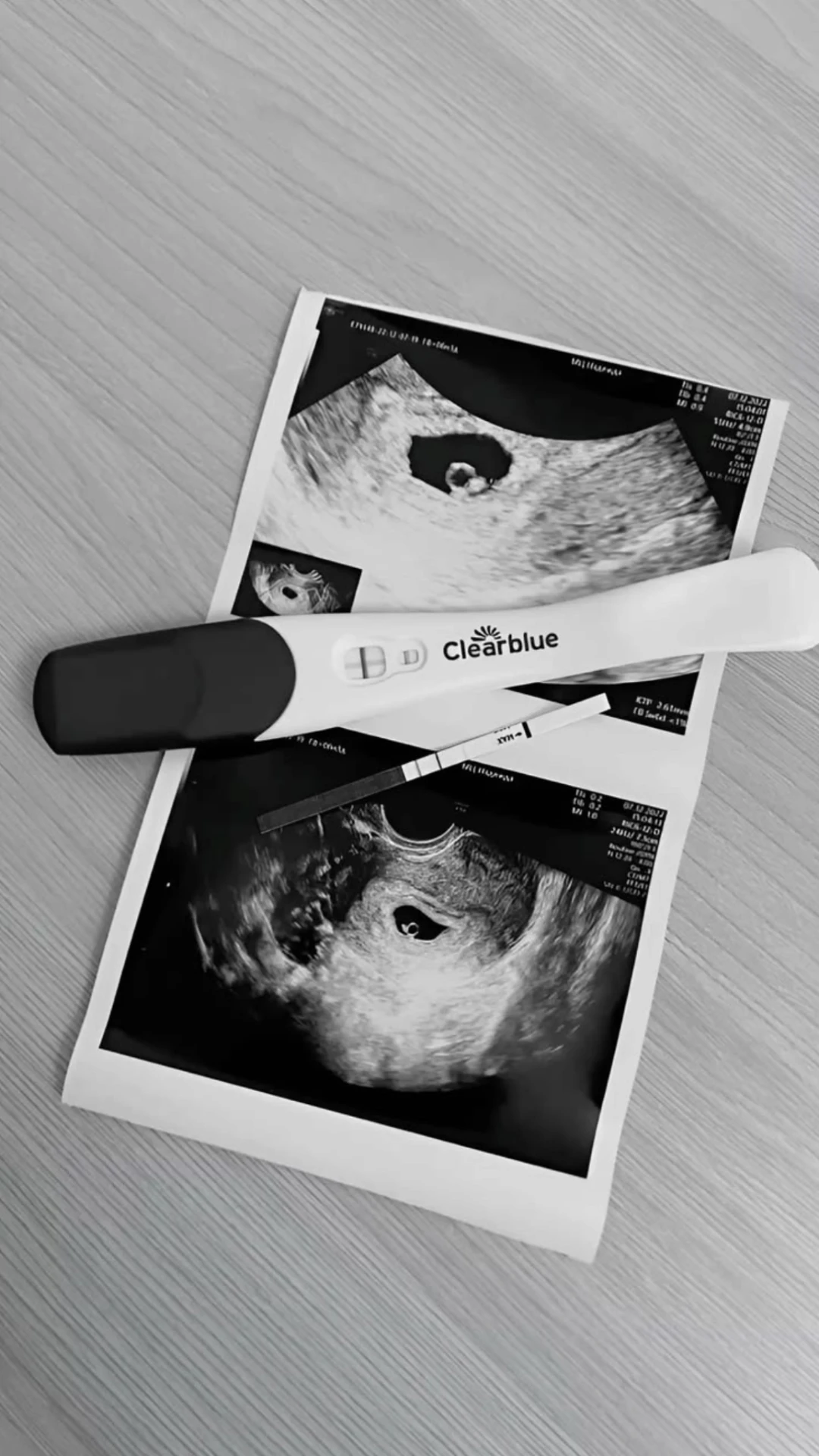Early pregnancy scan images beside a positive pregnancy test